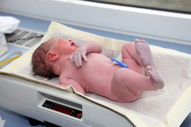  Bài kiểm tra điểm Apgar để kiểm tra tình trạng của trẻ sơ sinh-dsuckhoe 