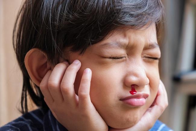  Tìm hiểu nguyên nhân chảy máu cam ở trẻ em khi ngủ-dsuckhoe 