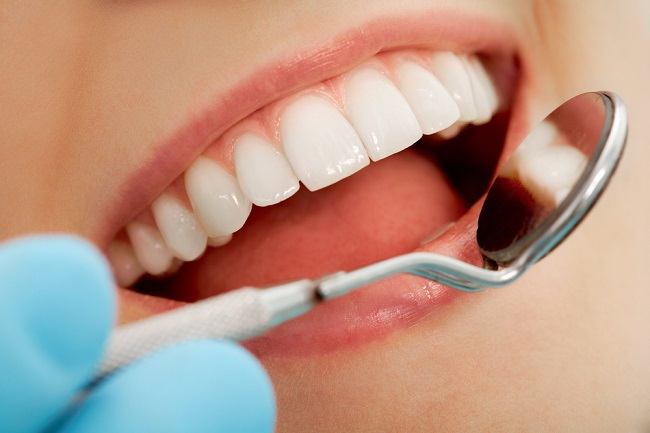  Những lý do cần phải nhổ răng và bất kỳ điều kiện nào cần xem xét - dsuckhoe 