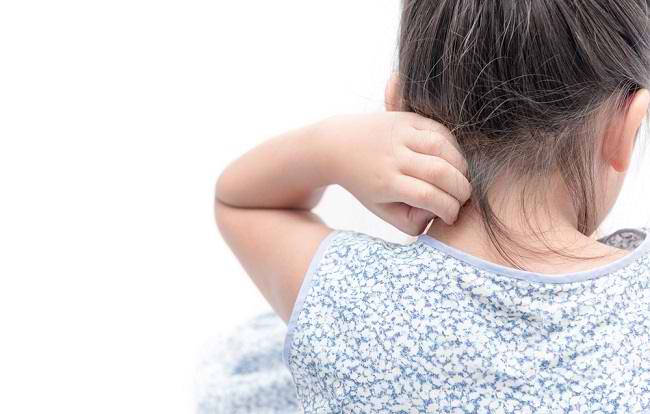  Các triệu chứng của dị ứng thuốc ở trẻ em mà cha mẹ nên biết-dsuckhoe 