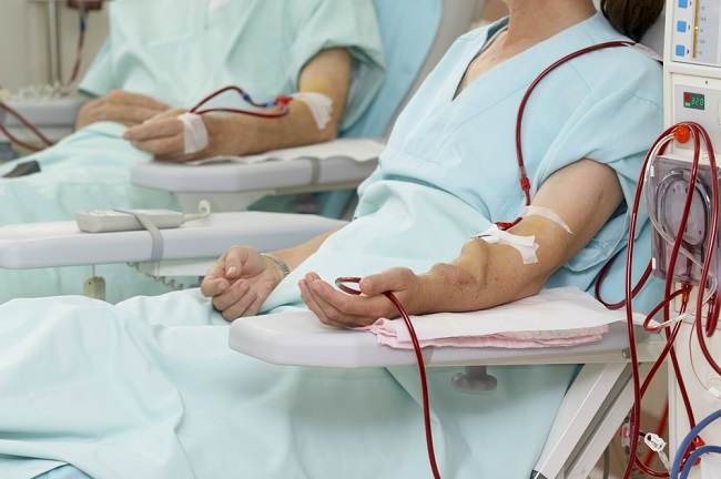  Các tùy chọn tiếp cận mạch máu khác nhau để rửa máu-dsuckhoe 