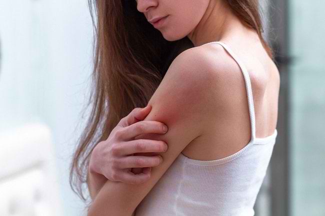  Coi chừng da bị ngứa có thể là dấu hiệu của bệnh nghiêm trọng-dsuckhoe 