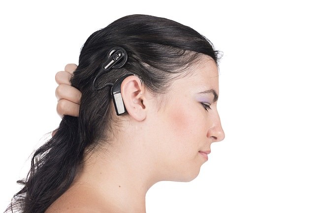 Biết Cấy ốc tai điện tử để có thính giác tốt hơn-dsuckhoe 