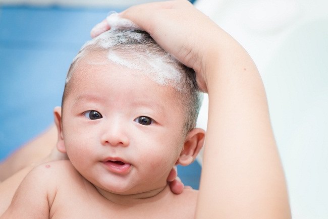  3 Bước Đơn giản để Loại bỏ gàu trên da đầu của trẻ sơ sinh - Allodokter 