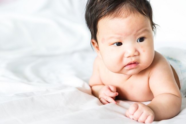  4 Mẹo giảm thiểu nguy cơ tái phát bệnh chàm ở trẻ sơ sinh - dsuckhoe 