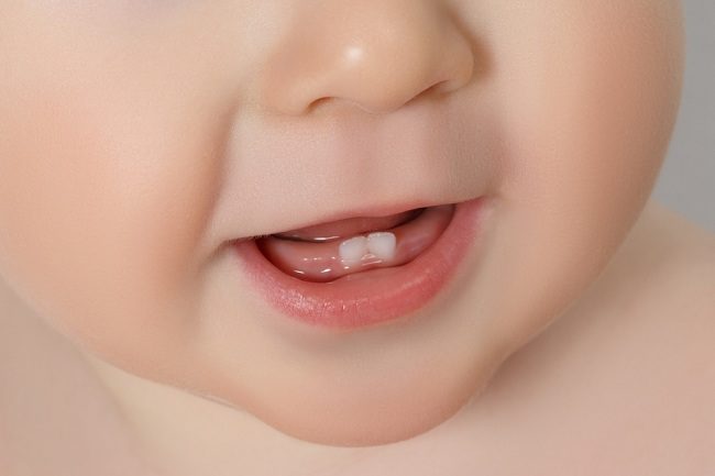  Giải pháp cho khiếu nại về răng mọc ở trẻ - dsuckhoe 