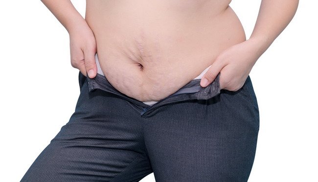  Hãy cẩn thận, đây là 8 nguy cơ cơ thể Quá béo phì - dsuckhoe 