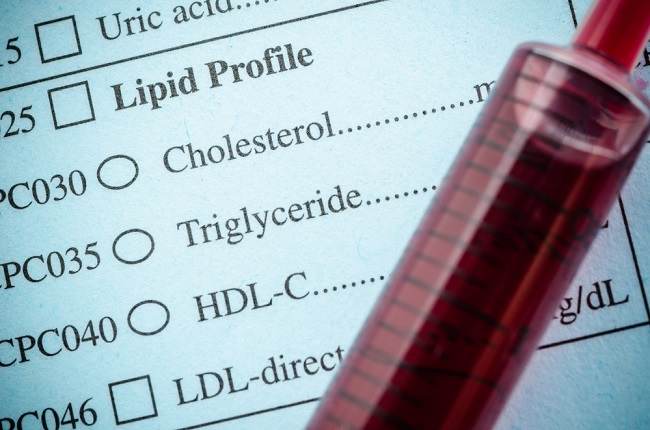  Kiểm tra Cholesterol: Lợi ích và Quy trình Thực hiện Bạn Cần biết-dsuckhoe 