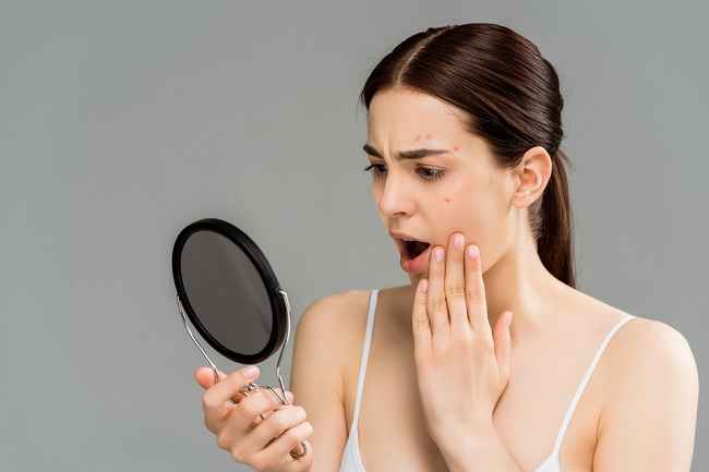  4 Vấn đề về Da Có thể Ảnh hưởng Căng thẳng đến The Skin - dsuckhoe 