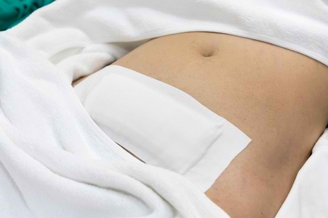  6 Cách xử lý vết khâu sau khi sinh để chữa bệnh nhanh - dsuckhoe 