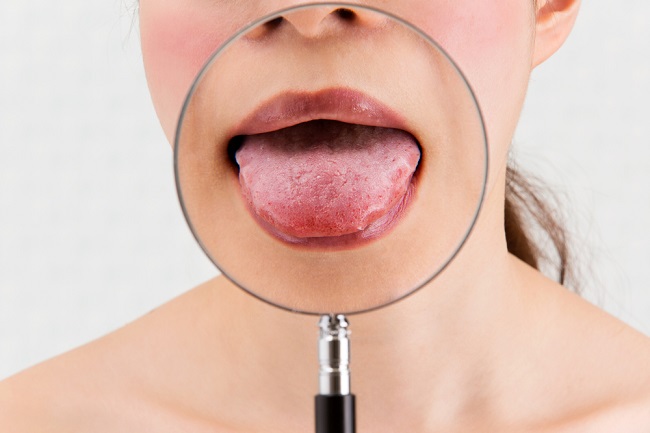  8 Chức năng ở Lưỡi và Rối loạn Có thể-dsuckhoe 