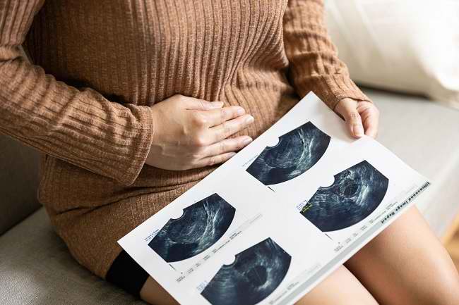  Tìm hiểu 8 Nguyên nhân Ung thư Cổ tử cung và Các yếu tố nguy cơ - dsuckhoe 