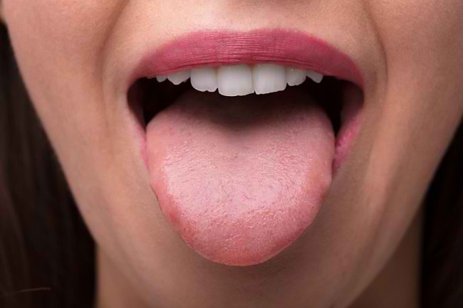  Tìm hiểu giải phẫu của lưỡi và các rối loạn có thể xảy ra-dsuckhoe 