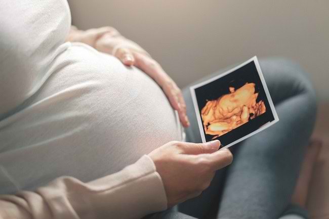  Thông tin thêm về Siêu âm 4 chiều trong thai kỳ-dsuckhoe 